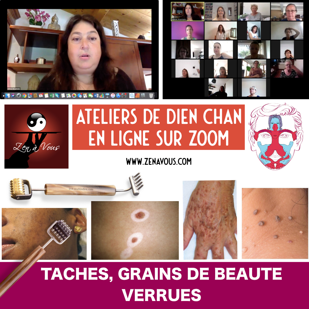 You are currently viewing Atelier Taches, grains de beauté, verrues