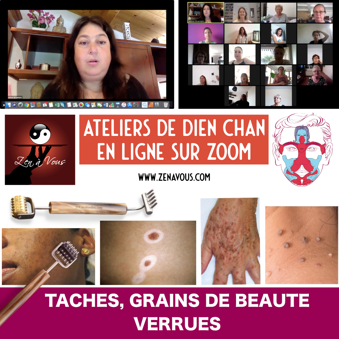 Lire la suite à propos de l’article Atelier Taches, grains de beauté, verrues